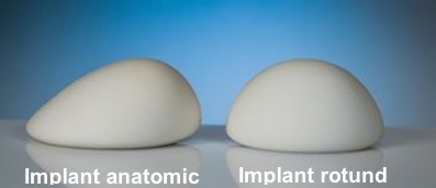 Implant mamar